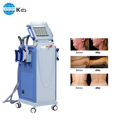 Membrana con mejores ventas vertical 10,4 del anticongelante de la máquina del cryolipolysis de la máquina de TFT que adelgaza en venta